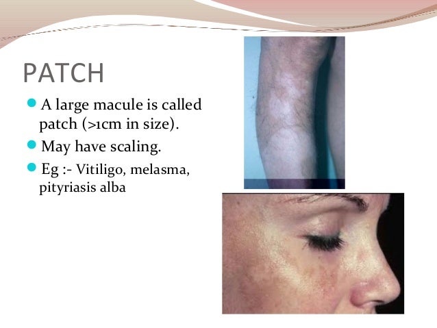 Facial lesion dermatology picture 699